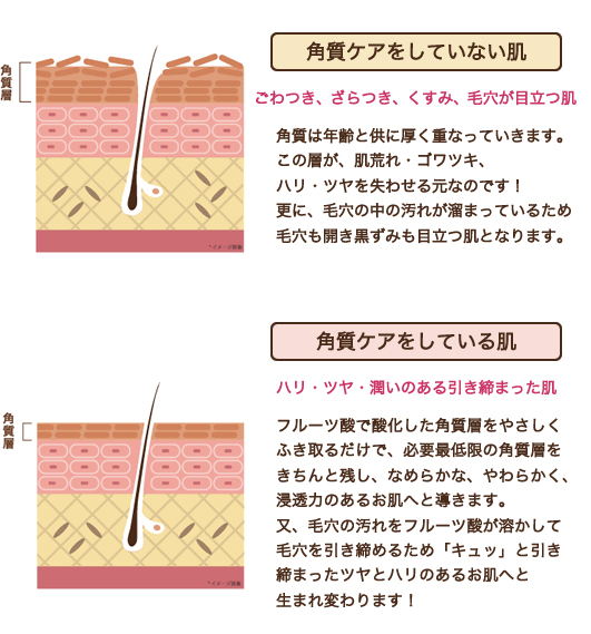 ネライダ　コーニアスローション　通販